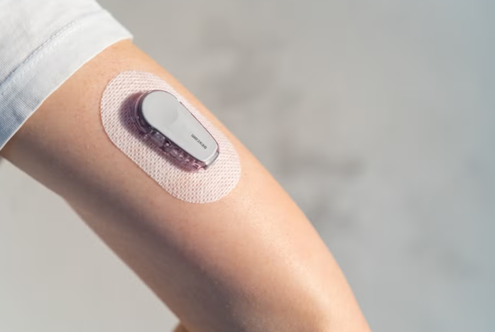 Glucose monitoring